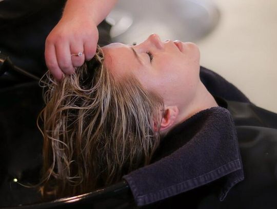 Uczucie napięcia skóry głowy przy łuszczycy